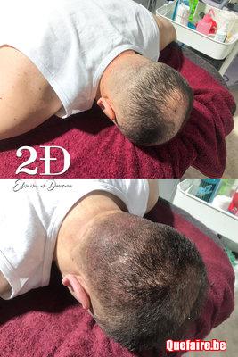 Cabinet de micro-pigmentation capillaire à...