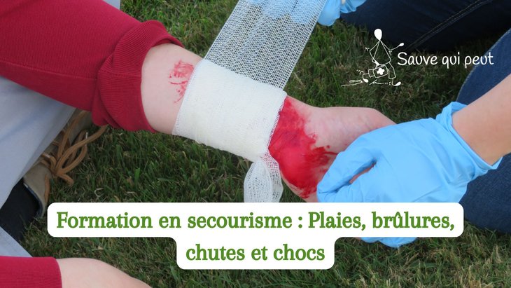 Stages,cours Formation premiers secours : Plaies, brûlures, chutes chocs